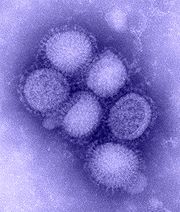 Pandemia Influenza A\H1N1: vera epidemia o montatura dei media?