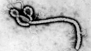 Ebola, primo caso sospetto negli Stati Uniti